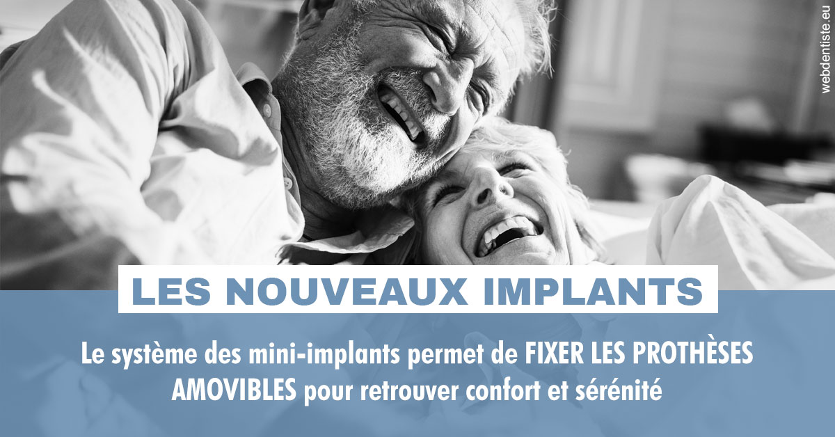 https://dr-leonard-vincent.chirurgiens-dentistes.fr/Les nouveaux implants 2