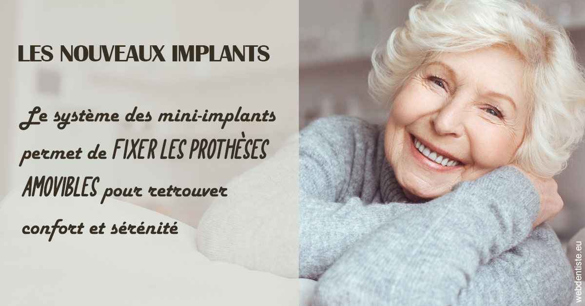 https://dr-leonard-vincent.chirurgiens-dentistes.fr/Les nouveaux implants 1