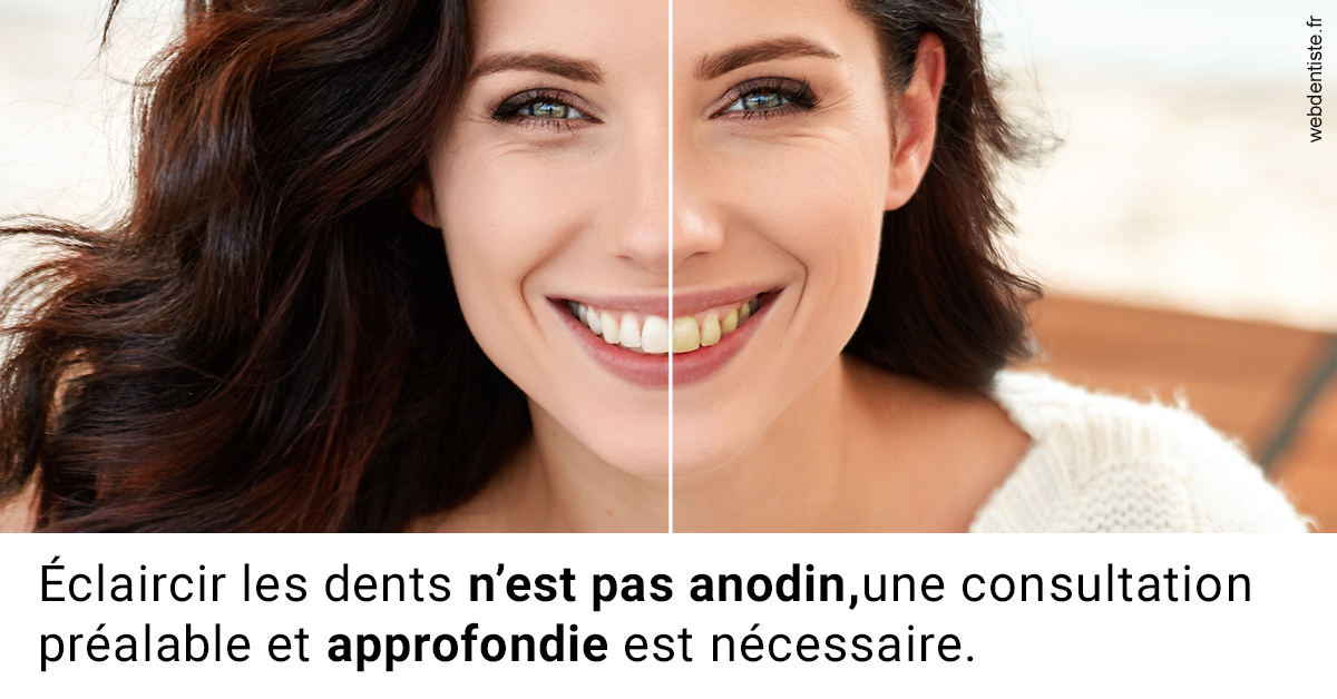 https://dr-leonard-vincent.chirurgiens-dentistes.fr/Le blanchiment 2