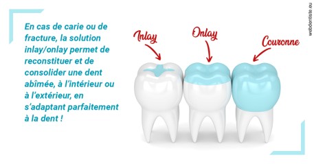 https://dr-leonard-vincent.chirurgiens-dentistes.fr/L'INLAY ou l'ONLAY