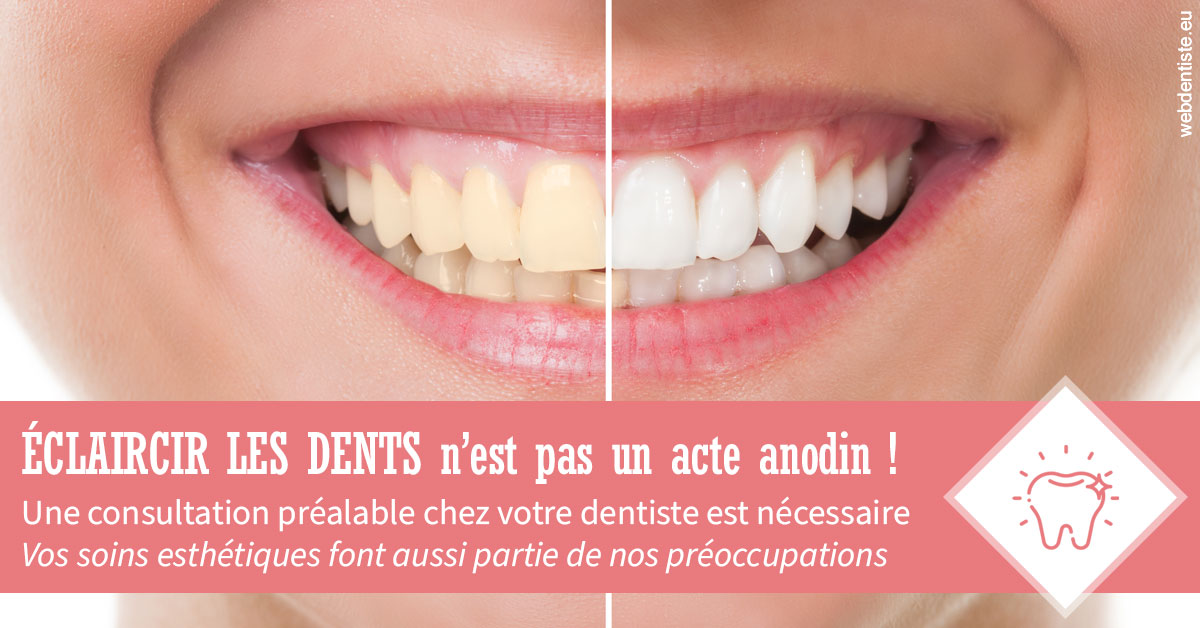 https://dr-leonard-vincent.chirurgiens-dentistes.fr/Eclaircir les dents 1