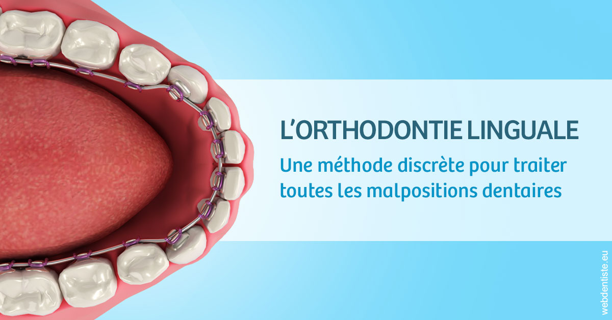 https://dr-leonard-vincent.chirurgiens-dentistes.fr/L'orthodontie linguale 1
