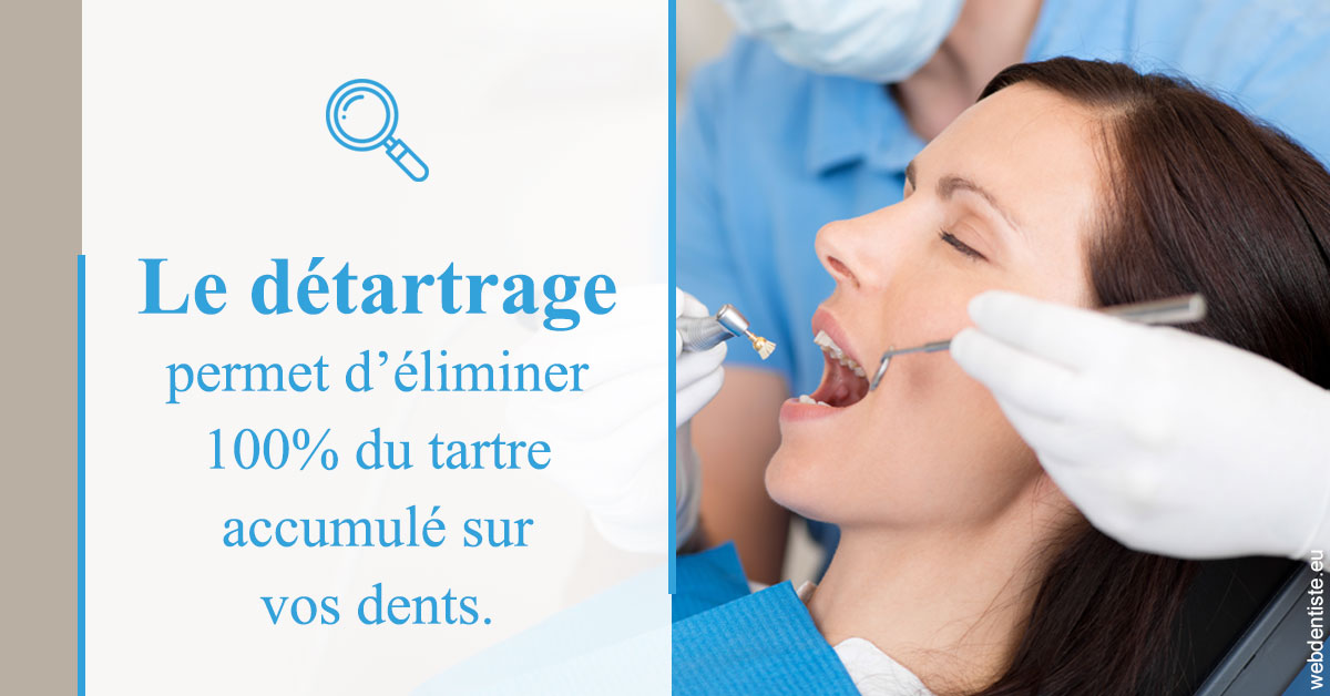 https://dr-leonard-vincent.chirurgiens-dentistes.fr/En quoi consiste le détartrage