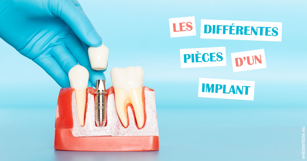 https://dr-leonard-vincent.chirurgiens-dentistes.fr/Les différentes pièces d’un implant 2