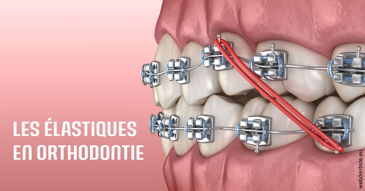 https://dr-leonard-vincent.chirurgiens-dentistes.fr/Elastiques orthodontie 2
