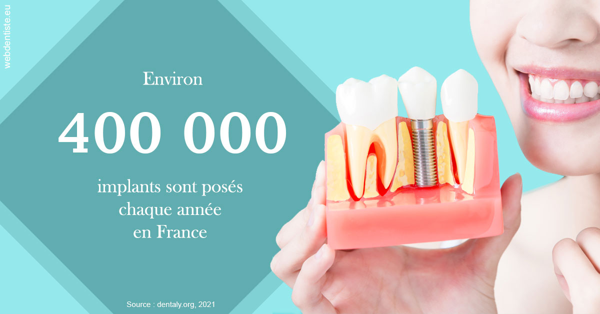 https://dr-leonard-vincent.chirurgiens-dentistes.fr/Pose d'implants en France 2